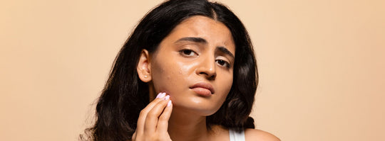 10 Common Acne Myths: Unravelling The Truth