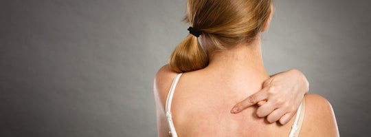 Do's And Don'ts For Back Acne You Must Consider